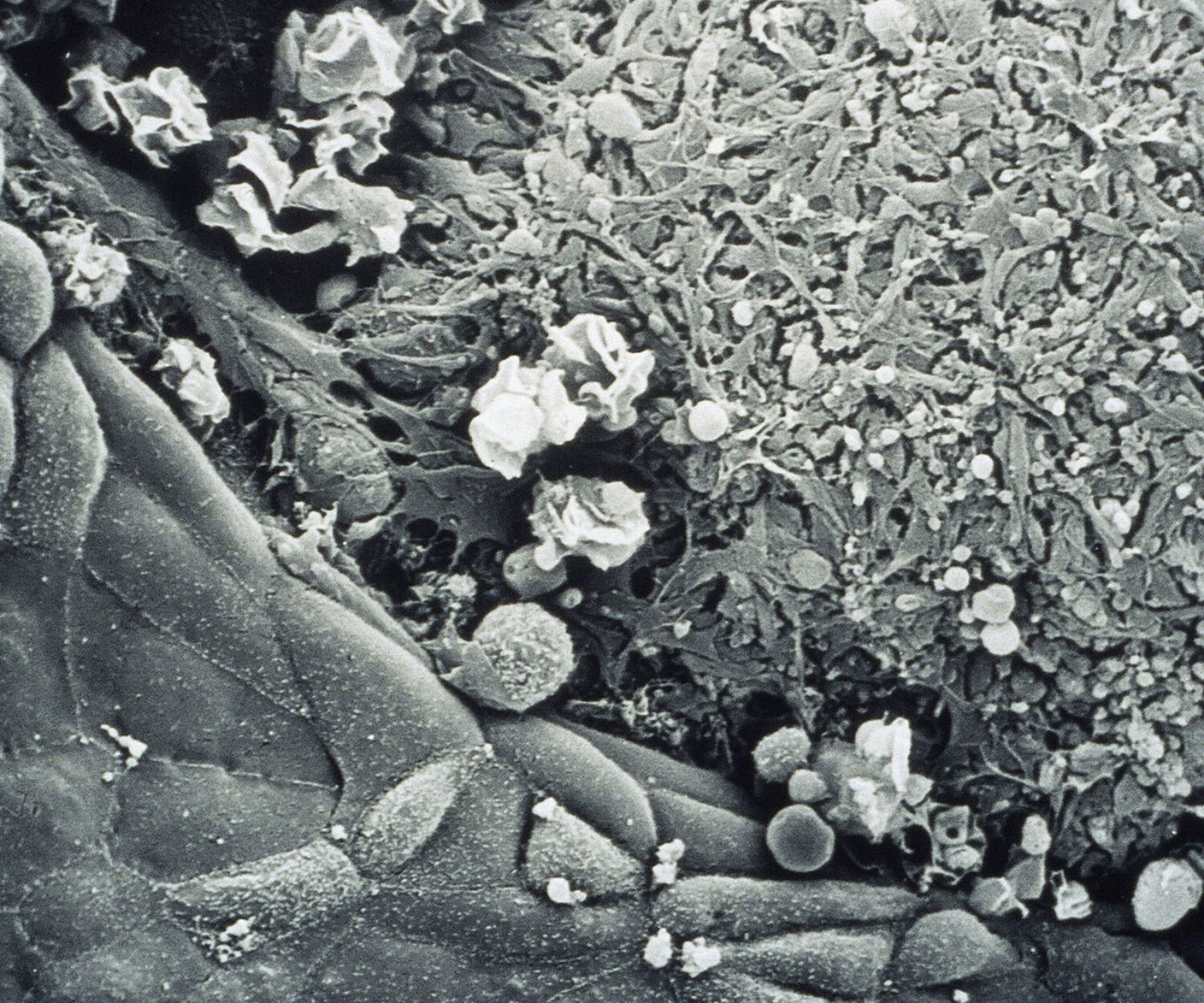 Licence: CC0 1.0 Universal Credit: embryo wound healing SEM. Paul Martin. Source: Wellcome Collection.